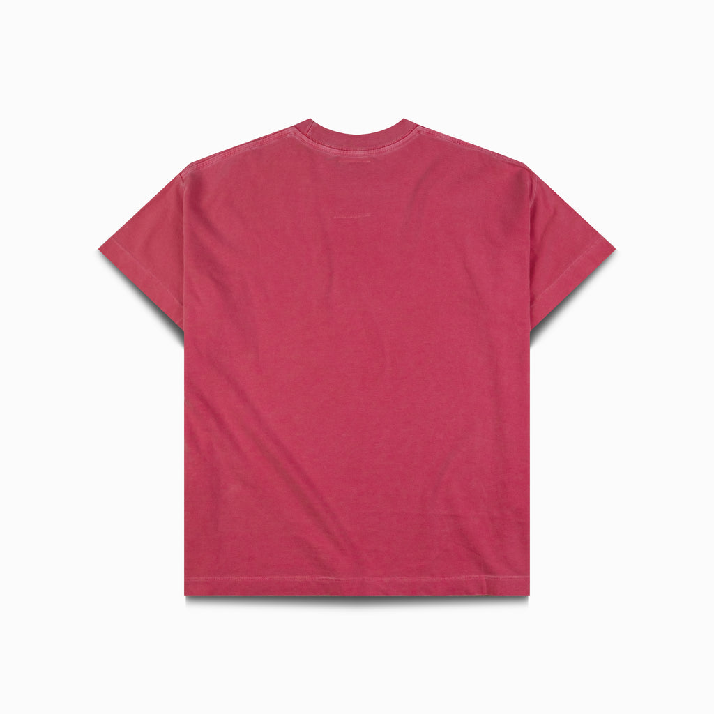 RADIOGRAPHIE TEE
