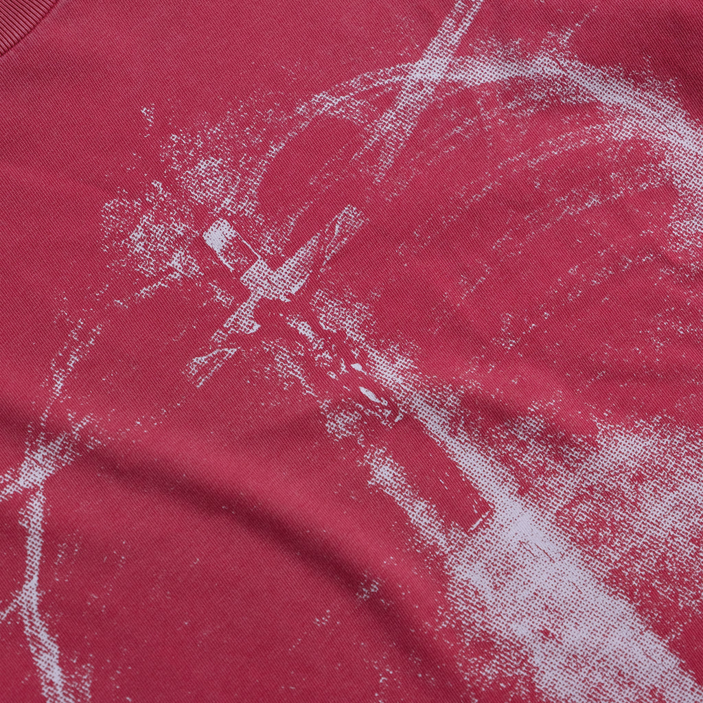 RADIOGRAPHIE TEE